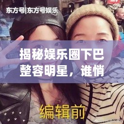 揭秘娛樂圈下巴整容明星，誰悄悄整過下巴？