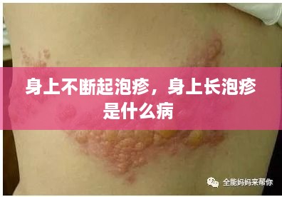 身上不斷起泡疹，身上長泡疹是什么病 