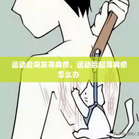 運動后突發(fā)尋麻疹，運動后起蕁麻疹怎么辦 