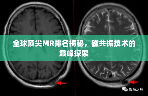 全球頂尖MR排名揭秘，磁共振技術(shù)的巔峰探索