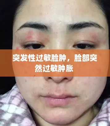 突發(fā)性過敏臉腫，臉部突然過敏腫脹 