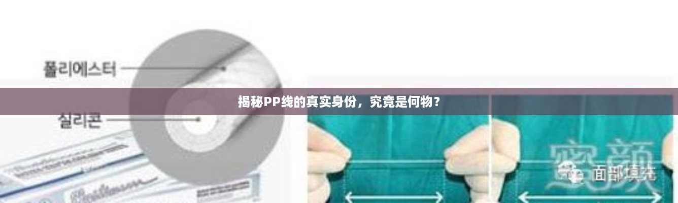 揭秘PP線的真實(shí)身份，究竟是何物？