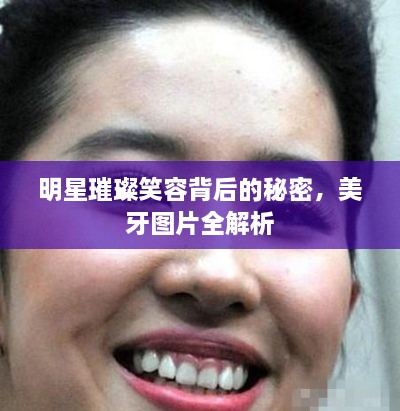 明星璀璨笑容背后的秘密，美牙圖片全解析