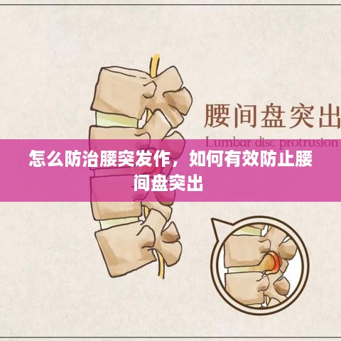 怎么防治腰突發(fā)作，如何有效防止腰間盤突出 