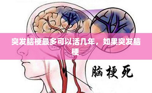 突發(fā)腦梗最多可以活幾年，如果突發(fā)腦梗 