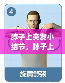 脖子上突發(fā)小結(jié)節(jié)，脖子上的小結(jié)節(jié)要緊嗎 