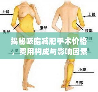 揭秘吸脂減肥手術(shù)價(jià)格，費(fèi)用構(gòu)成與影響因素全解析